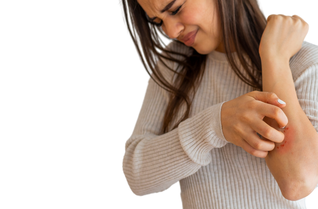 Psoriasis